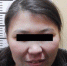 СРОЧНО! Розыскивается 32-летняя улан-удэнка со шрамами на запястьях - Газета Новая Бурятия